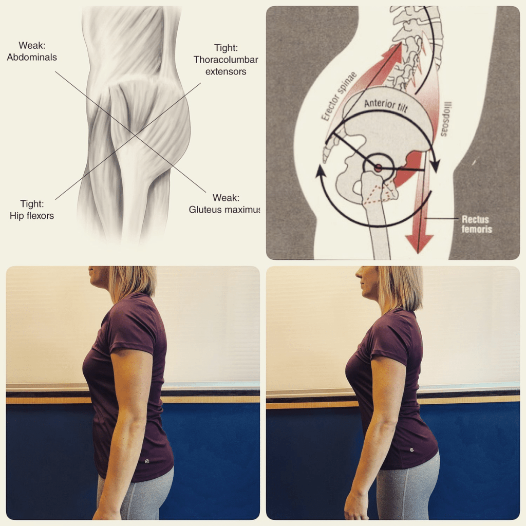 疲れやすいのは姿勢のせいかもしれない！?猫背・まき肩を克服